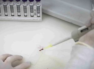 exames-descartam-ebola-em-imigrante-da-republica-democratica-do-congo